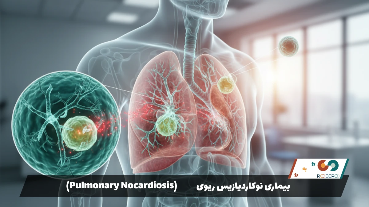 بیماری نوکاردیازیس ریوی (Pulmonary Nocardiosis)