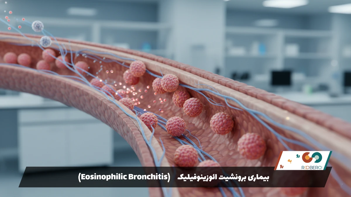 بیماری برونشیت ائوزینوفیلیک (Eosinophilic Bronchitis)