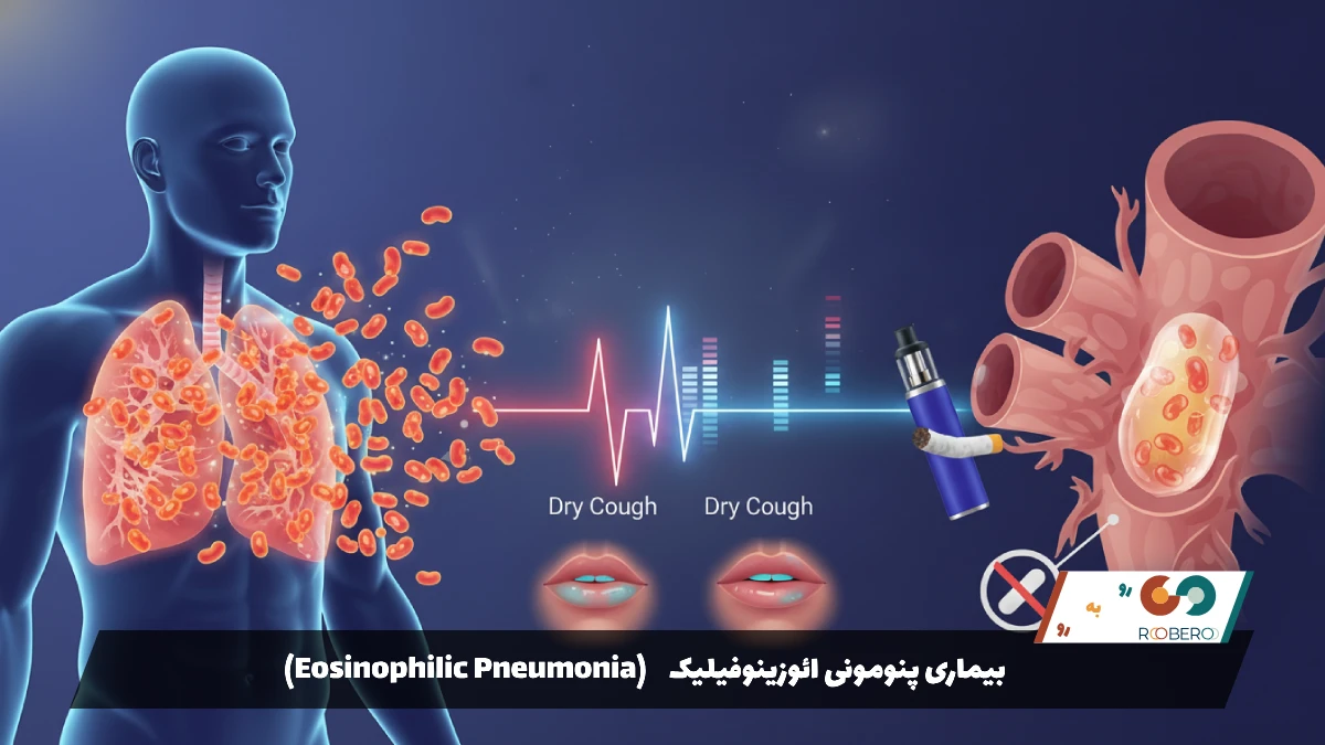 بیماری پنومونی ائوزینوفیلیک (Eosinophilic Pneumonia)