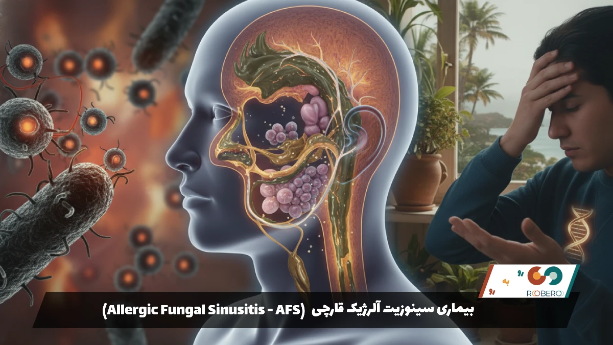 بیماری سینوزیت آلرژیک قارچی (Allergic Fungal Sinusitis – AFS)