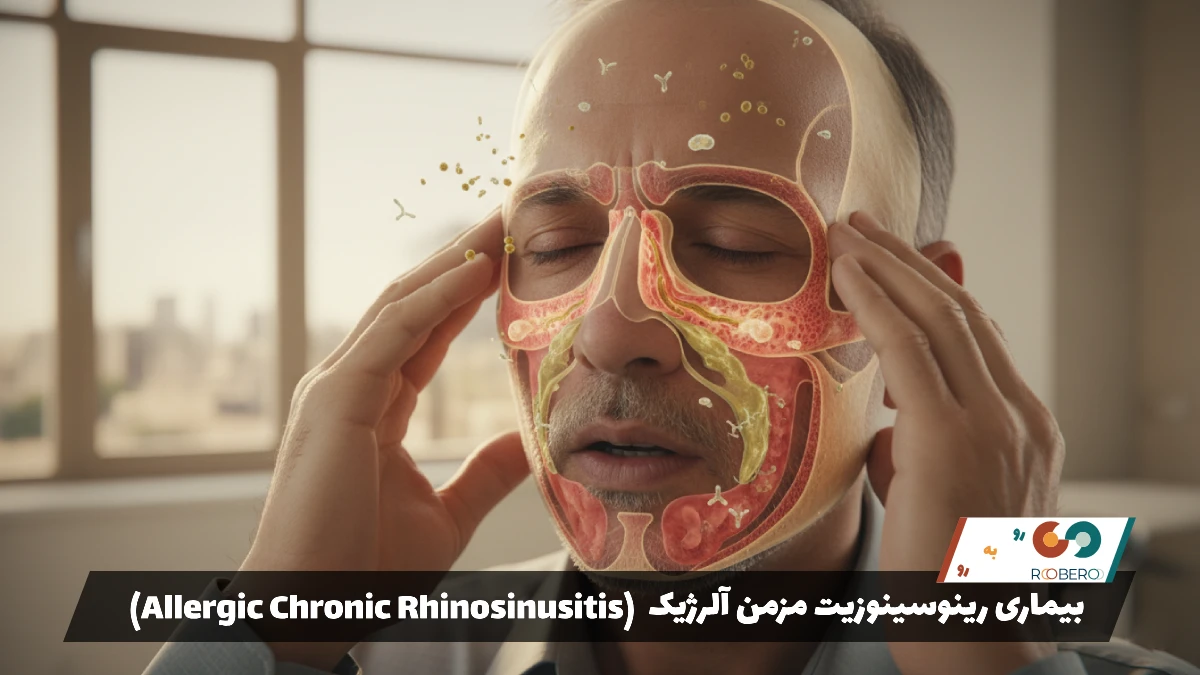 بیماری رینوسینوزیت مزمن آلرژیک (Allergic Chronic Rhinosinusitis)