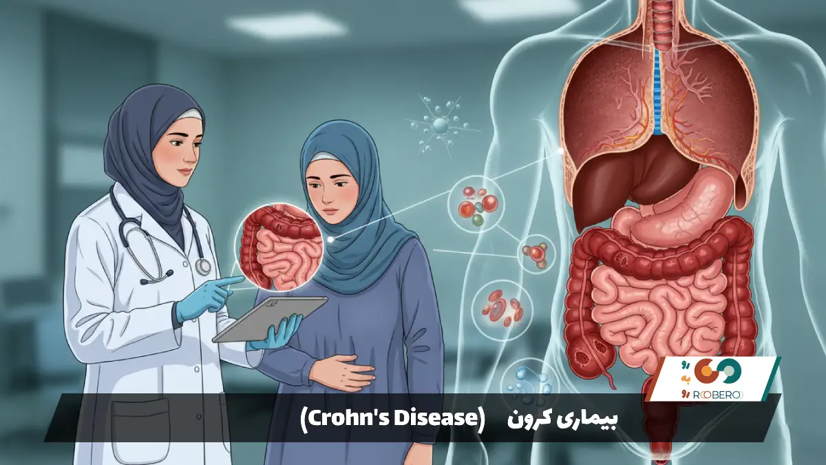 بیماری کرون (Crohn’s Disease)