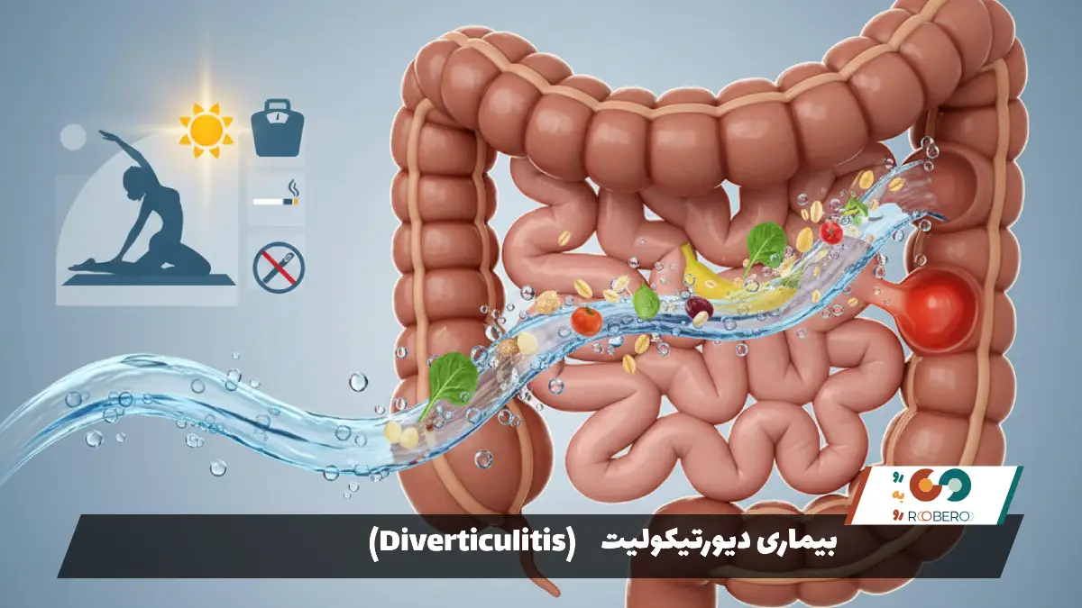 بیماری دیورتیکولیت (Diverticulitis)