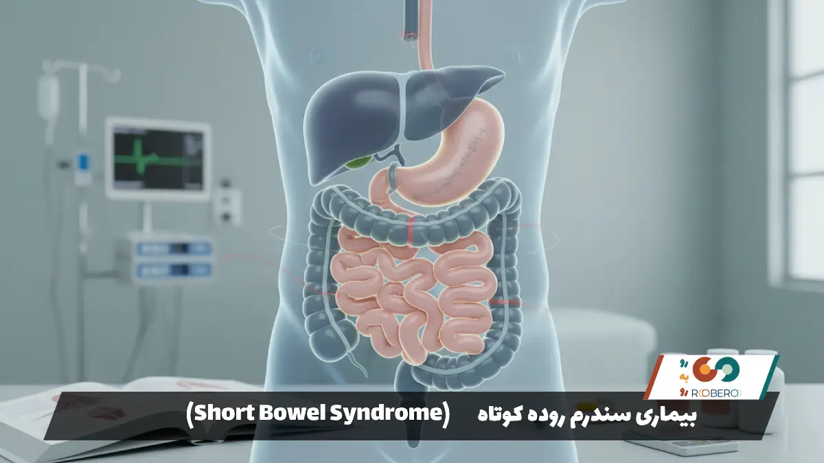بیماری سندرم روده کوتاه (Short Bowel Syndrome)