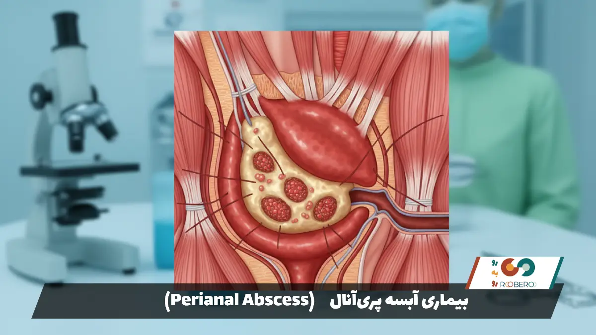 بیماری آبسه پری‌آنال (Perianal Abscess)