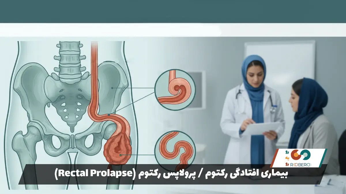 بیماری افتادگی رکتوم / پرولاپس رکتوم (Rectal Prolapse)