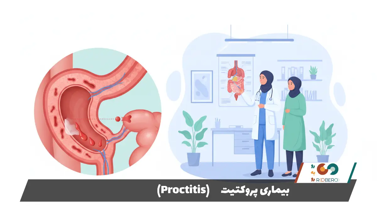 بیماری پروکتیت (Proctitis)
