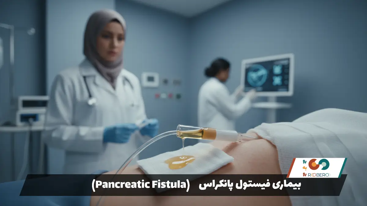 بیماری فیستول پانکراس (Pancreatic Fistula)