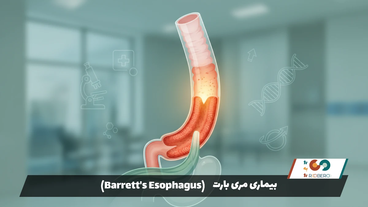 بیماری مری بارت (Barrett’s Esophagus)