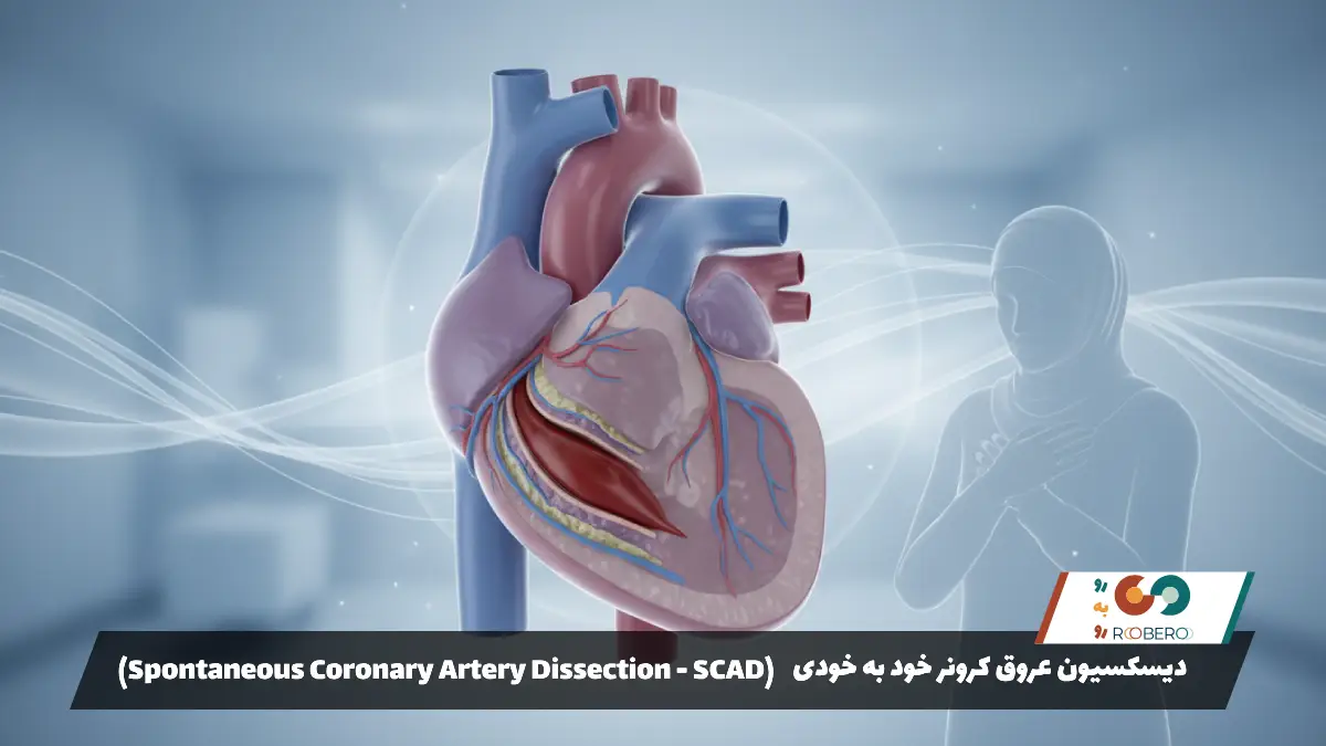 بیماری دیسکسیون عروق کرونر خود به خودی (Spontaneous Coronary Artery Dissection – SCAD)