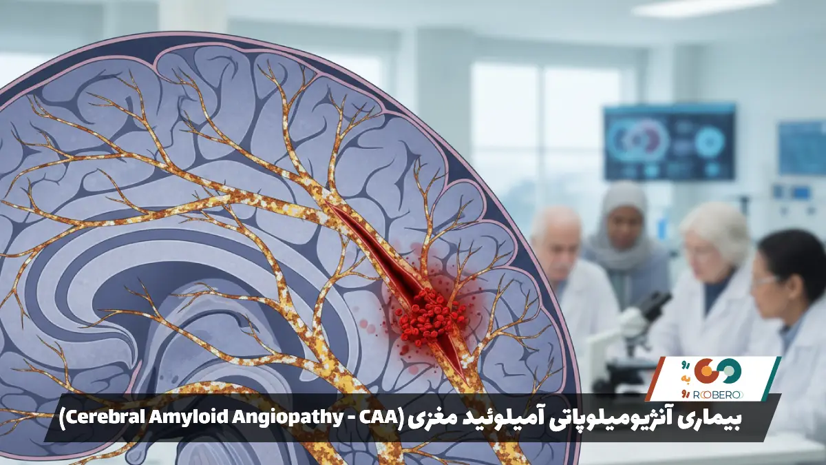 بیماری آنژیومیلوپاتی آمیلوئید مغزی (Cerebral Amyloid Angiopathy – CAA)