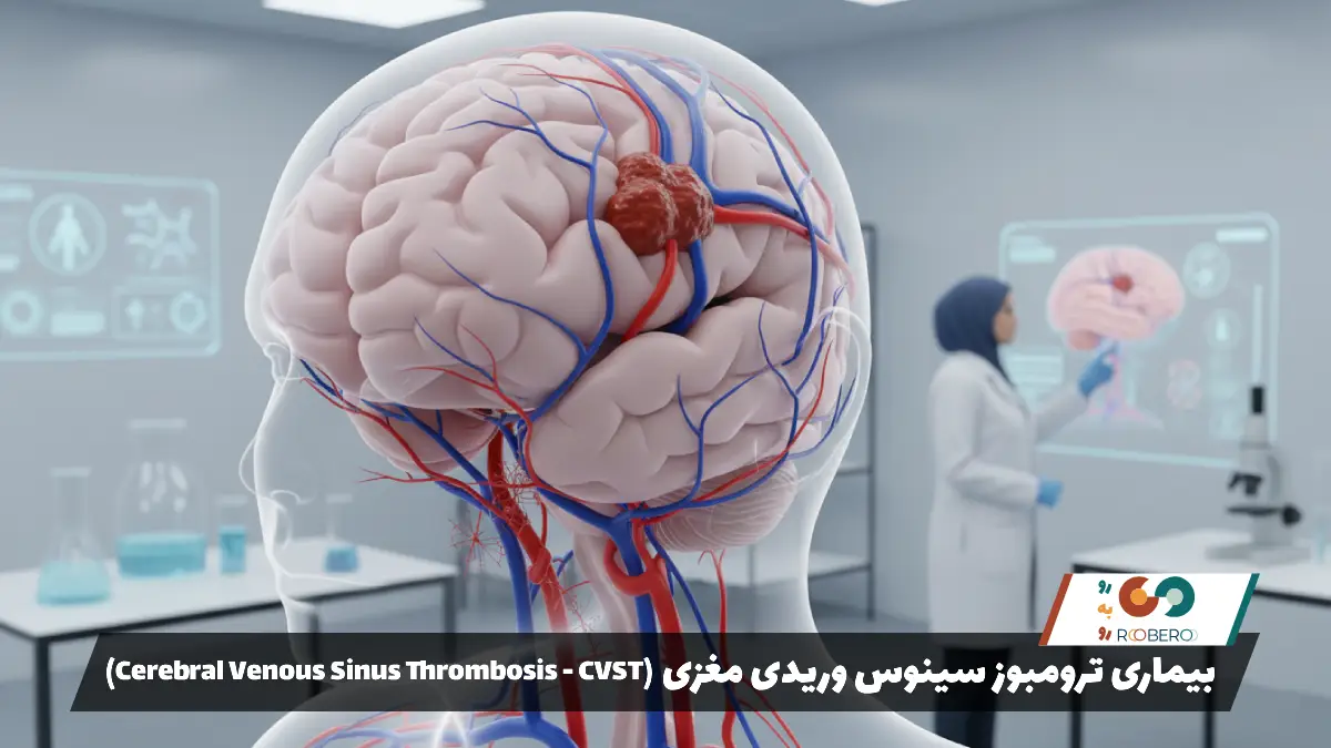 بیماری ترومبوز سینوس وریدی مغزی (Cerebral Venous Sinus Thrombosis – CVST)