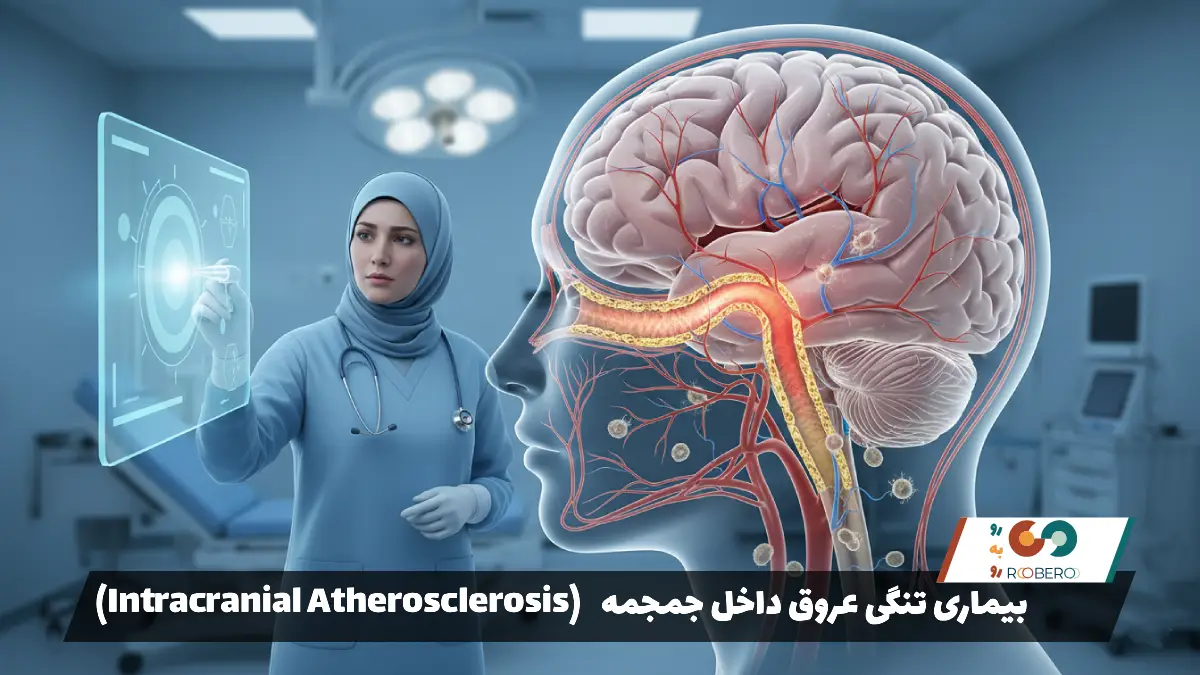 بیماری تنگی عروق داخل جمجمه (Intracranial Atherosclerosis)