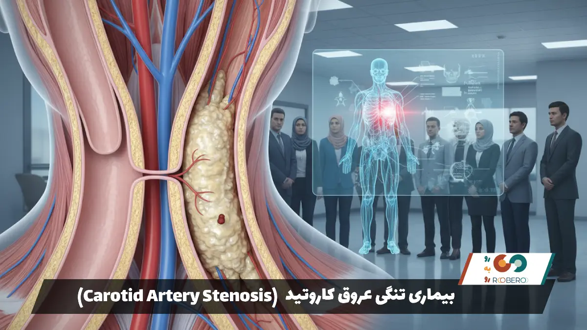 بیماری تنگی عروق کاروتید (Carotid Artery Stenosis)