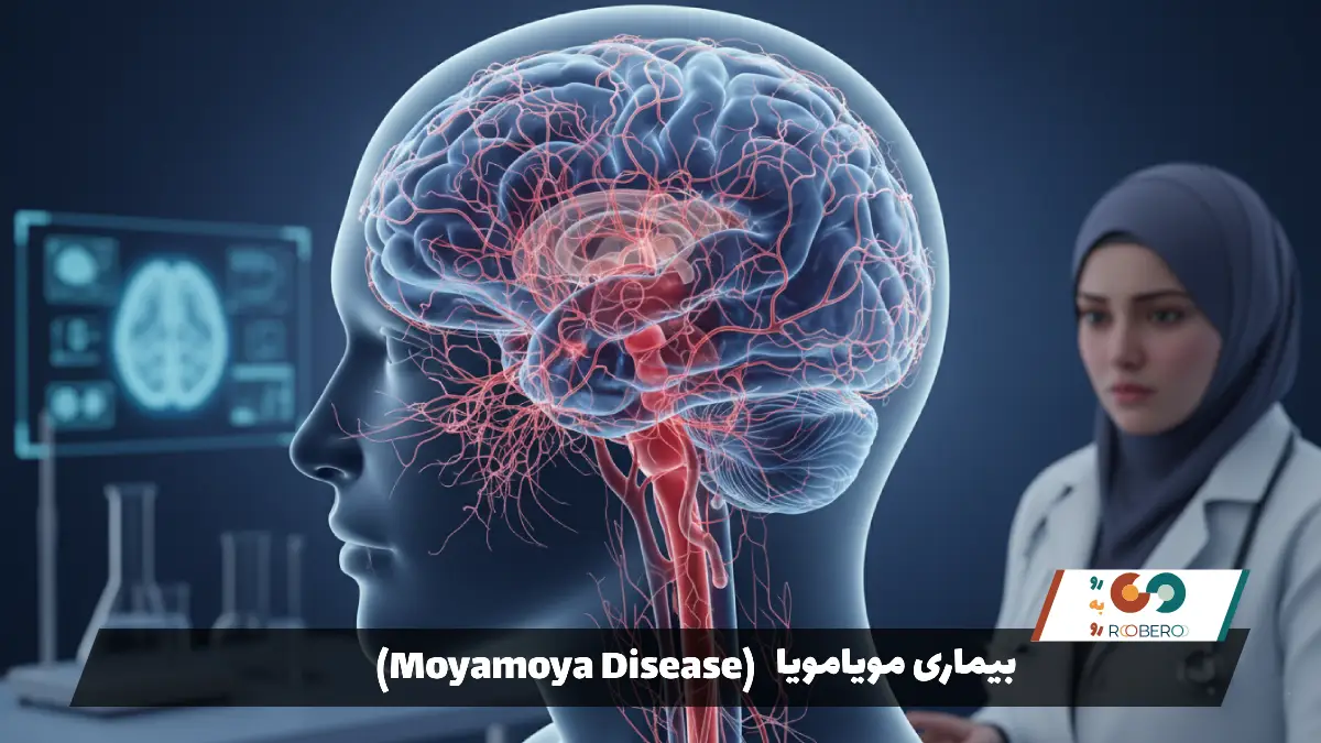 بیماری مویامویا (Moyamoya Disease)