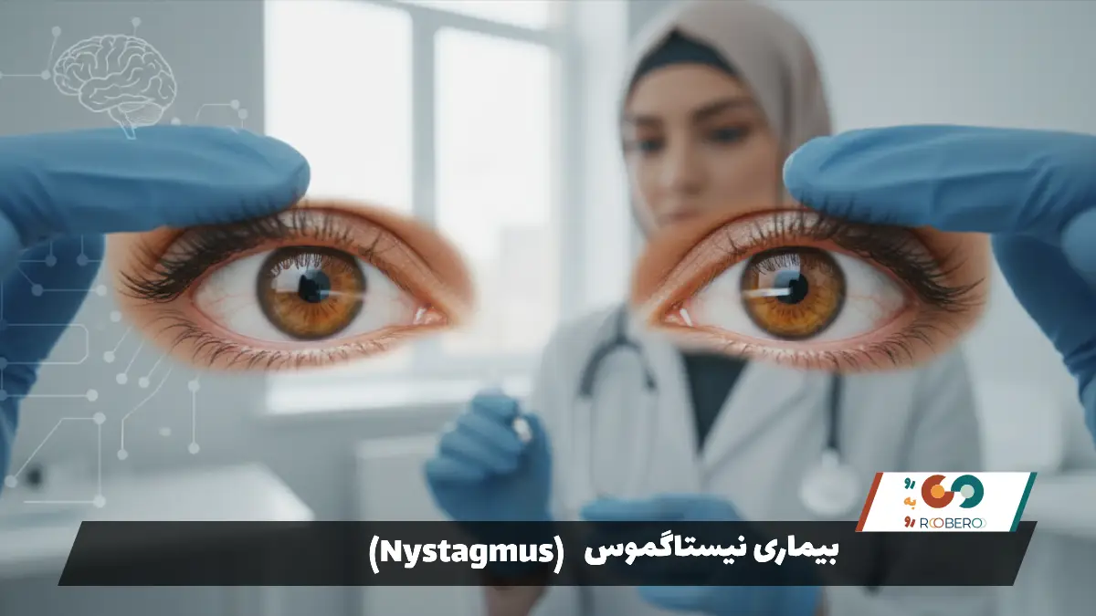 بیماری نیستاگموس (Nystagmus)