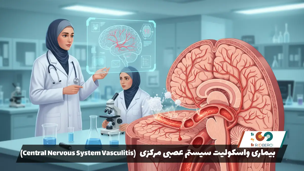 بیماری واسکولیت سیستم عصبی مرکزی (Central Nervous System Vasculitis)