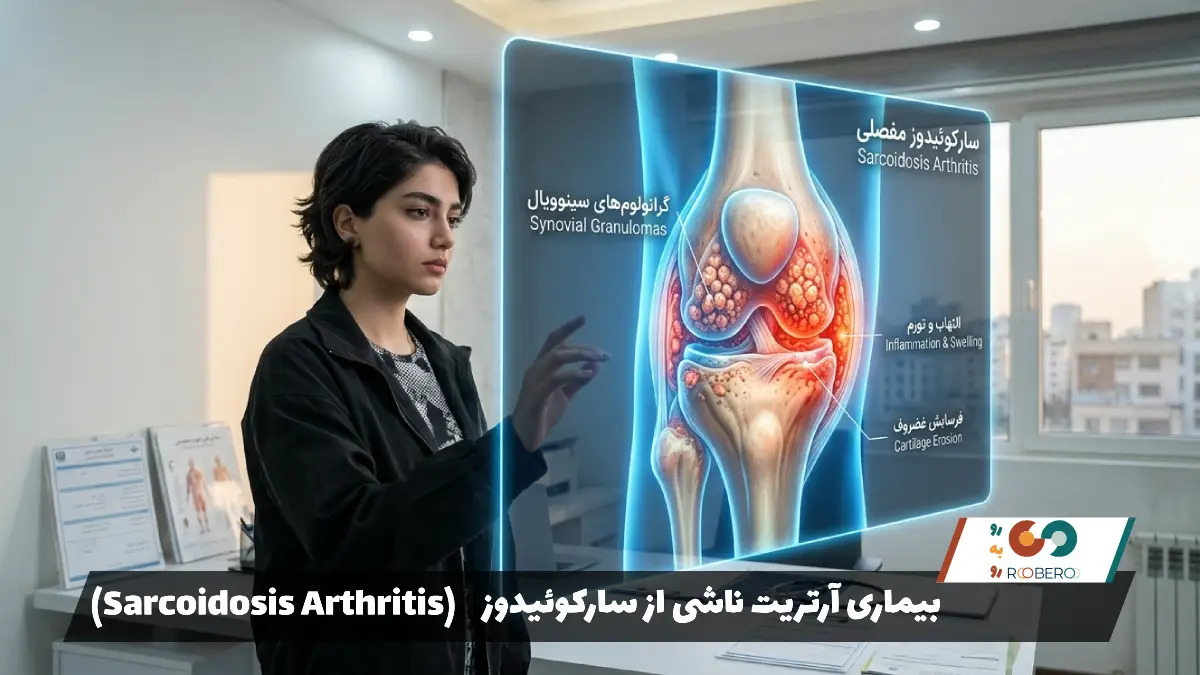 بیماری آرتریت ناشی از سارکوئیدوز (Sarcoidosis Arthritis)