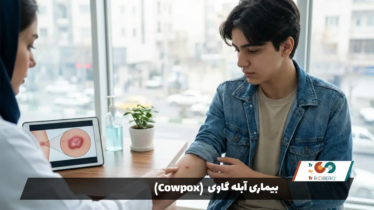 بیماری آبله گاوی (Cowpox)