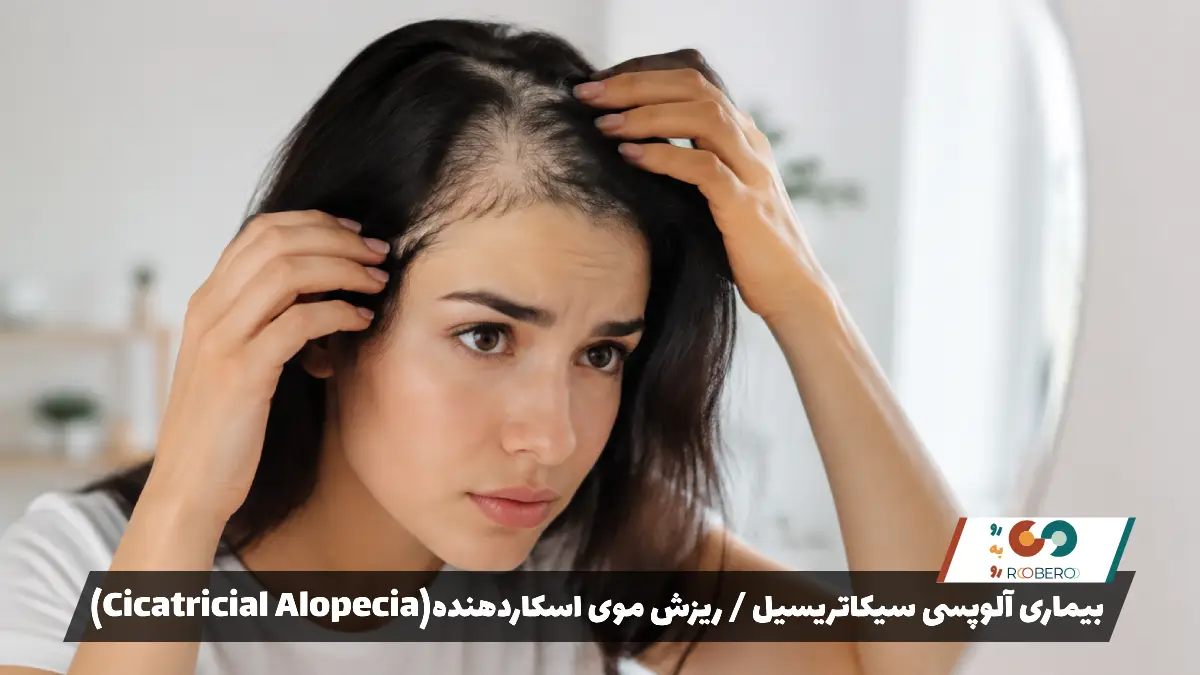 بیماری آلوپسی سیکاتریسیل / ریزش موی اسکاردهنده (Cicatricial Alopecia)
