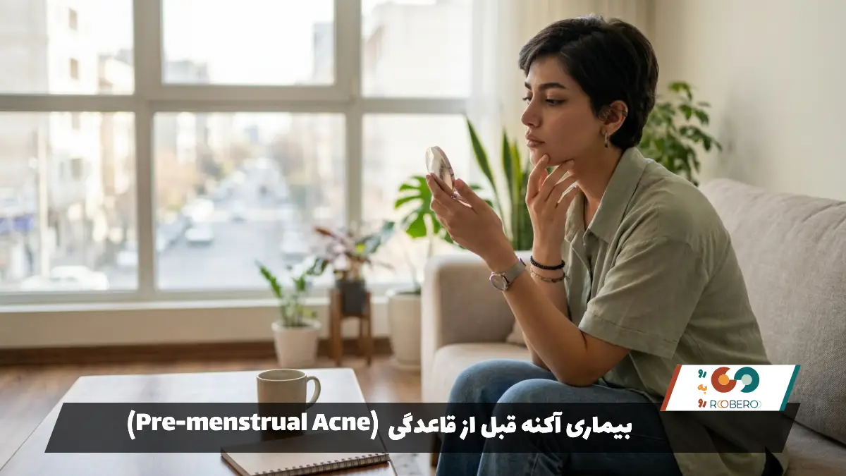 بیماری آکنه قبل از قاعدگی (Pre-menstrual Acne)
