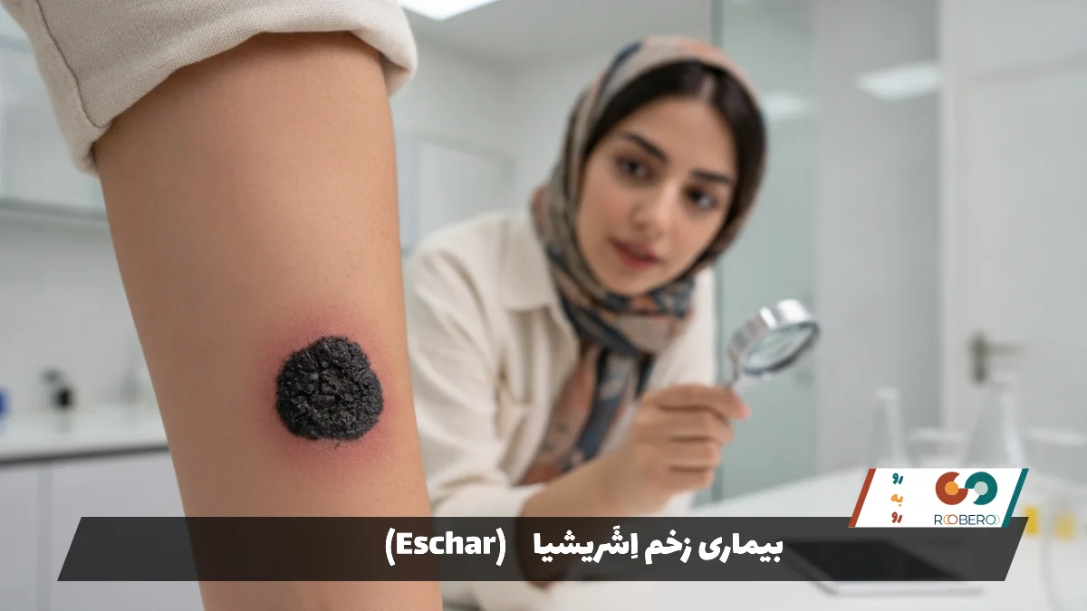 بیماری زخم اِشَریشیا (Eschar)