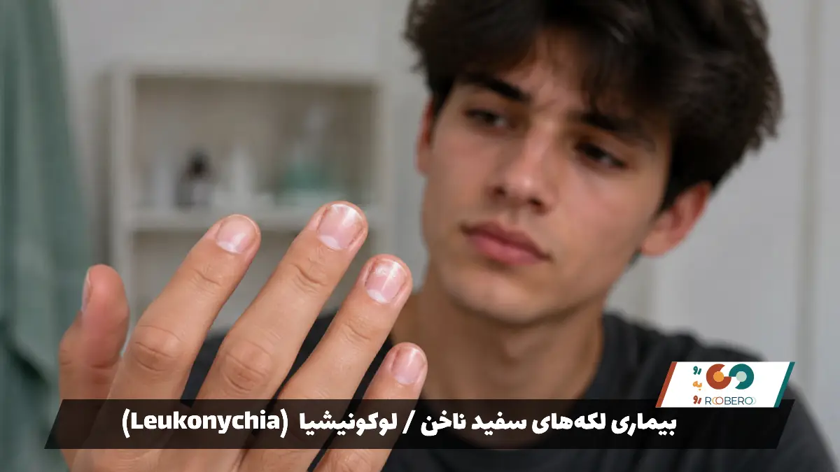 بیماری لکه‌های سفید ناخن / لوکونیشیا (Leukonychia)