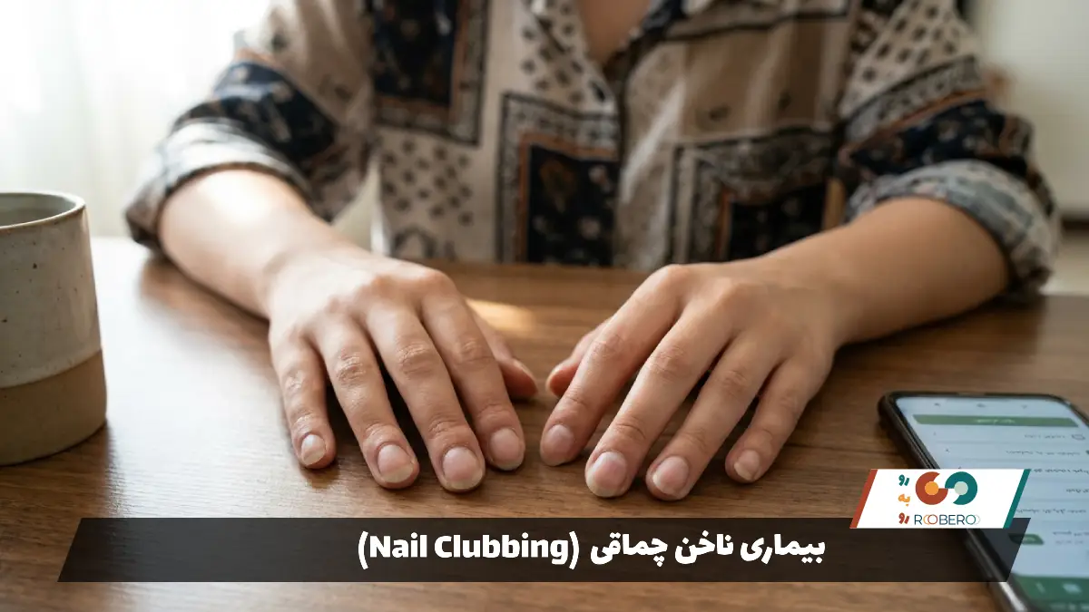 بیماری ناخن چماقی (Nail Clubbing)