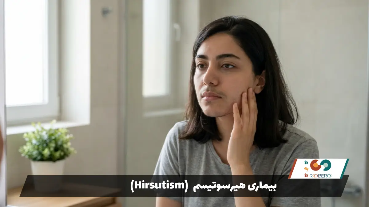 بیماری هیرسوتیسم (Hirsutism)