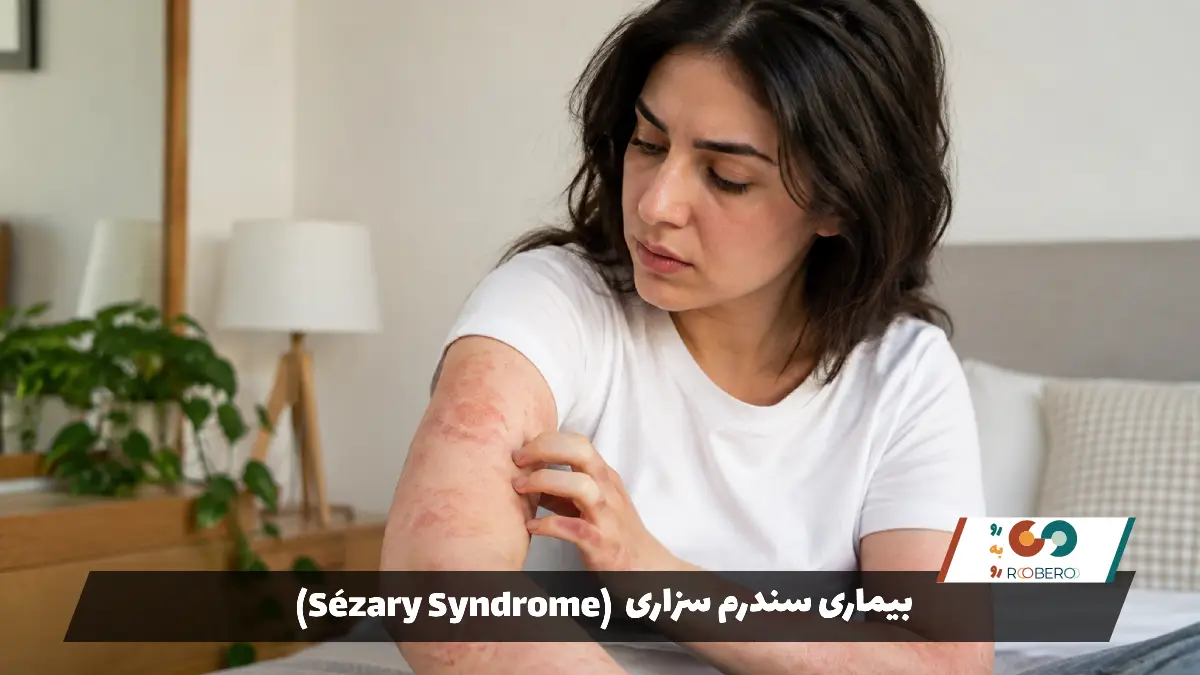 بیماری سندرم سزاری (Sézary Syndrome)