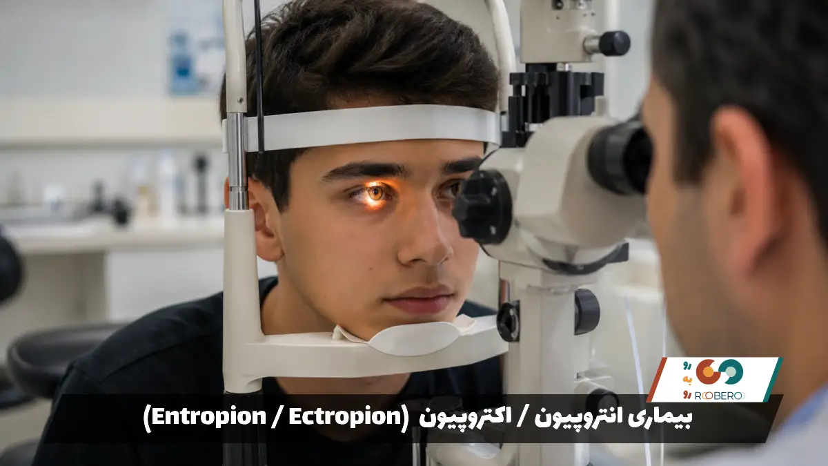 بیماری‌ انتروپیون / اکتروپیون (Entropion / Ectropion)